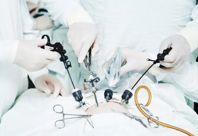 Laparoscopic Surgery for Ectopic Pregnancy