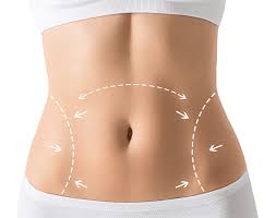 What is The Difference Between Liposuction and Tummy Tuck?